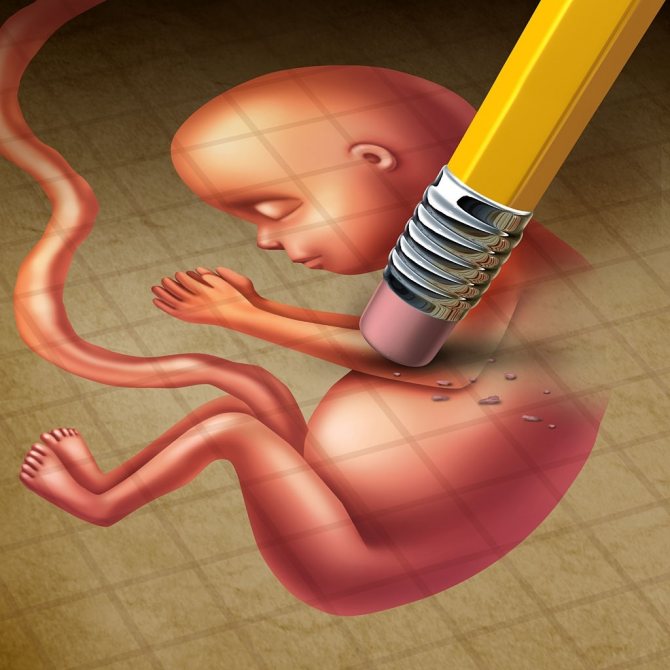 приснилась абортация