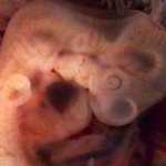 сонник аборт
